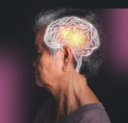 Dementia Treatment