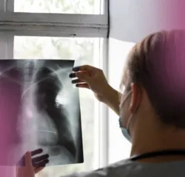 Pneumonia Treatment