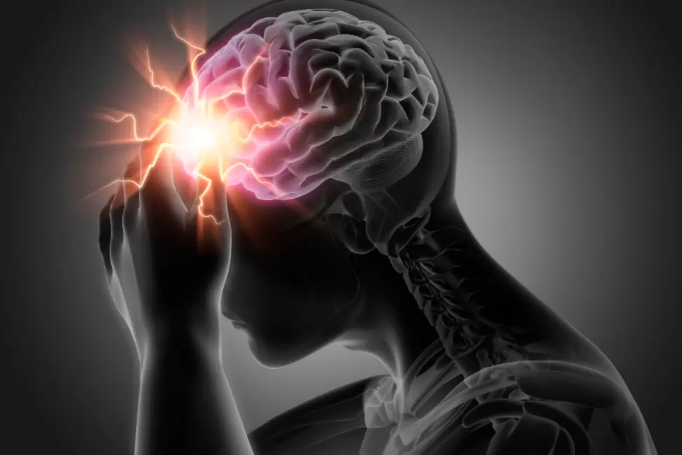Stroke vs. Migraine