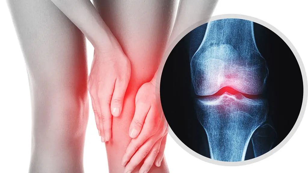 Bone Diseases