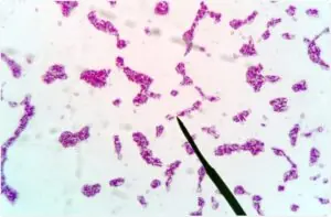 botulism treatment