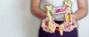 Inflammatory Bowel Disease Treatment