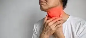 Esophagitis Treatment
